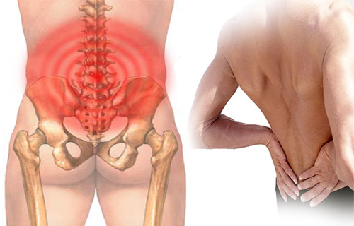 Tìm hiểu bệnh đau lưng